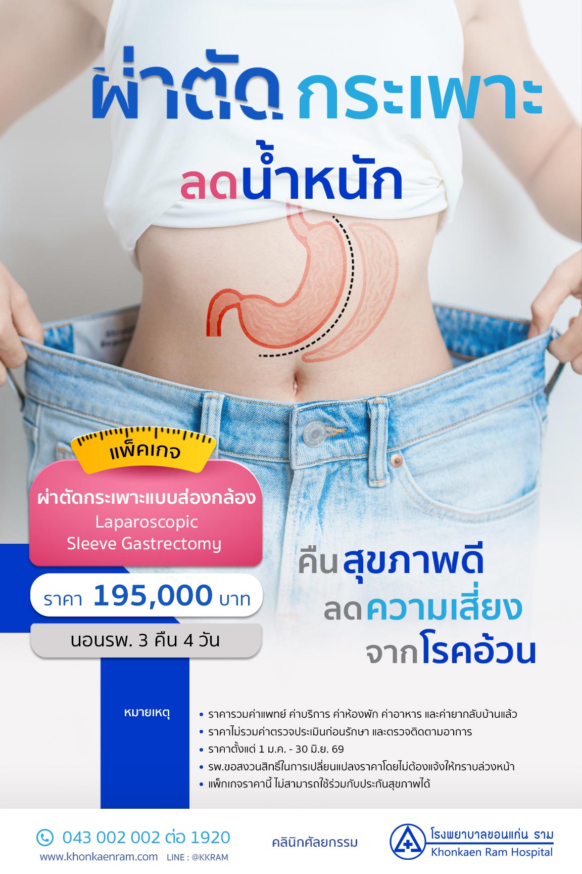 Pac Pos Gastric Sleeve v2